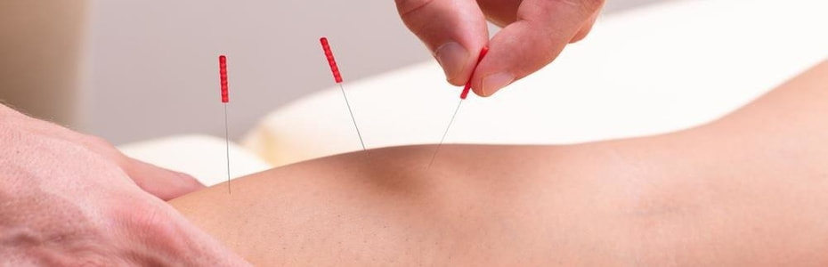 Long Island Medical Acupuncture